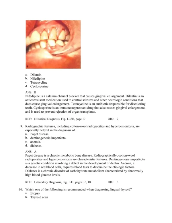 Oral Pathology for the Dental Hygienist 8th Edition Olga Ibsen Test Bank_Page4.webp-004 Chapter-based oral pathology test questions covering disease processes and lesion identification